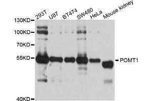 Western blot analysis of extract of various cells, using POMT1 antibody. (POMT1 anticorps)
