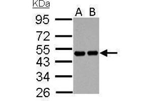 WB Image RCC1 antibody detects RCC1 protein by Western blot analysis. (RCC1 anticorps)