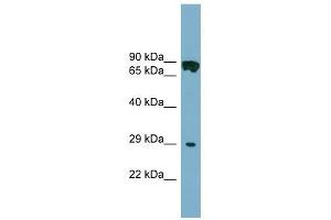CYB5D1 antibody used at 1 ug/ml to detect target protein. (CYB5D1 anticorps  (Middle Region))