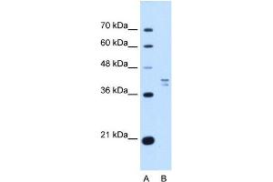 PSAT1 antibody used at 1 ug/ml to detect target protein. (PSAT1 anticorps  (N-Term))