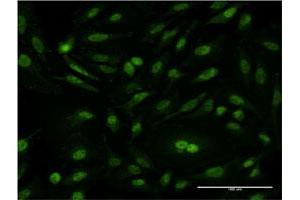 Immunofluorescence of monoclonal antibody to CSE1L on HeLa cell. (Exportin 2 anticorps  (AA 872-971))