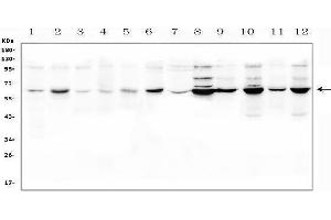 anti-Solute Carrier Family 19 (Folate Transporter), Member 1 (SLC19A1) (AA 202-231), (Middle Region) antibody