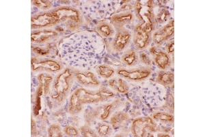 Anti-P Glycoprotein Picoband antibody,  IHC(P): Rat Kidney Tissue (ABCB1 anticorps  (Middle Region))