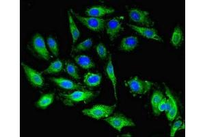 Immunofluorescent analysis of Hela cells using ABIN7144769 at dilution of 1:100 and Alexa Fluor 488-congugated AffiniPure Goat Anti-Rabbit IgG(H+L)