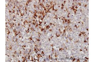 Immunoperoxidase of monoclonal antibody to APOA2 on formalin-fixed paraffin-embedded human malignant lymphoma, diffuse large B. (APOA2 anticorps  (AA 1-100))