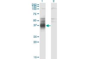Western Blot analysis of TMIGD1 expression in transfected 293T cell line by TMIGD1 monoclonal antibody (M01), clone 4A8. (TMIGD1 anticorps  (AA 1-262))