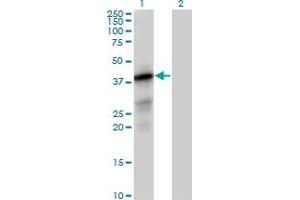 Western Blot analysis of PTPLAD1 expression in transfected 293T cell line by PTPLAD1 MaxPab polyclonal antibody. (PTPLAD1 anticorps  (AA 1-362))