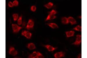 ABIN6267630 staining 293 by IF/ICC. (Acetyl-CoA Carboxylase alpha anticorps  (pSer79))