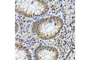 Immunohistochemistry of paraffin-embedded human appendix using Phospho-ERK1-T202 + ERK2-T185 antibody (ABIN7268610) at dilution of 1:100 (40x lens). (ERK1/2 anticorps  (pThr185, pThr202))