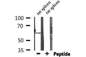 Western blot analysis of extracts from rat spleen, using NT5E Antibody. (CD73 anticorps  (N-Term))