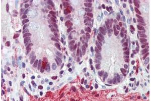 Human Small Intestine (formalin-fixed, paraffin-embedded) stained with FUS antibody ABIN462224 followed by biotinylated goat anti-rabbit IgG secondary antibody ABIN481713, alkaline phosphatase-streptavidin and chromogen.