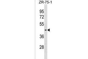 SLC30A10 Antibody (C-term) (ABIN1537148 and ABIN2838295) western blot analysis in ZR-75-1 cell line lysates (35 μg/lane). (SLC30A10 anticorps  (AA 331-359))