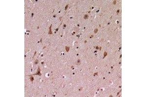 Immunohistochemical analysis of PDCD12 staining in human brain formalin fixed paraffin embedded tissue section.
