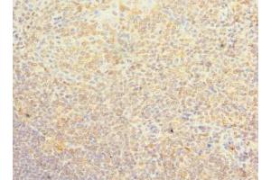 Immunohistochemistry of paraffin-embedded human tonsil tissue using ABIN7163030 at dilution of 1:100 (PSD4 anticorps  (AA 1-300))