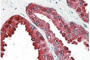 AP31101PU-N ACPP antibody staining of paraffin embedded Human Prostate at 3. (ACPP anticorps  (Internal Region))