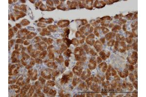 Immunoperoxidase of monoclonal antibody to MTM1 on formalin-fixed paraffin-embedded human pancreas. (MTM1 anticorps  (AA 1-100))