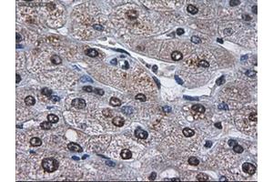 Immunohistochemistry (IHC) image for anti-alpha-Fetoprotein (AFP) (AA 19-397) antibody (ABIN2716008)