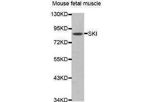 Western Blotting (WB) image for anti-SKI Proto-Oncogene (SKI) antibody (ABIN1682718) (SKI anticorps)