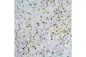 Immunohistochemical analysis of CACNG5 staining in rat brain formalin fixed paraffin embedded tissue section. (CACNG5 anticorps)