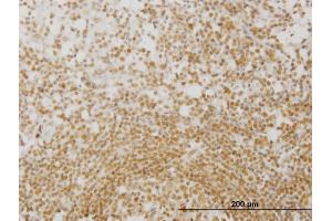 Immunoperoxidase of monoclonal antibody to MPG on formalin-fixed paraffin-embedded human lymph node. (MPG anticorps  (AA 1-90))