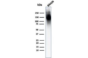 Western Blot Analysis of human Brain tissue lysate using Neurofilament Mouse Monoclonal Antibody (2F11). (NEFH & NEFL anticorps)