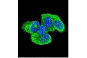 Confocal immunofluorescent analysis of HRAS Antibody (C-term) Cat.