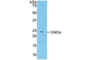 Western blot analysis of recombinant Mouse PCDHb2. (PCDHb2 anticorps  (AA 79-253))