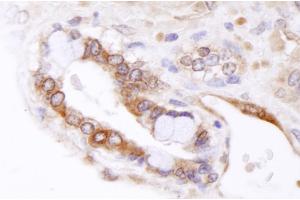 Immunohistochemistry (IHC) image for anti-ATP-Binding Cassette, Sub-Family B (MDR/TAP), Member 9 (ABCB9) (AA 475-525) antibody (ABIN7448927)