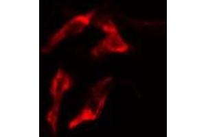 ABIN6277603 staining  MCF7 cells by IF/ICC. (PEX19 anticorps  (Internal Region))