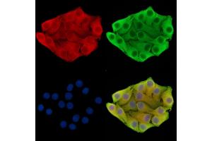 ABIN7095873 and ABIN7099935 staining Hela cells by IF/ICC.