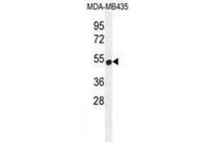 ZNF286B Antibody (N-term) western blot analysis in MDA-MB435 cell line lysates (35 µg/lane). (ZNF286B anticorps  (N-Term))