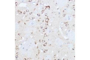 Immunohistochemistry of paraffin-embedded mouse brain using YTHDF3 Rabbit pAb (ABIN6130934, ABIN6150345, ABIN6150346 and ABIN6224441) at dilution of 1:500 (40x lens). (YTHDF3 anticorps  (AA 1-275))