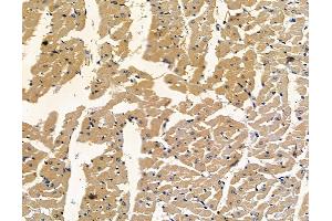 ABIN7096936 and ABIN7101002 at 1/100 staining rat heart tissue by IHC-P.