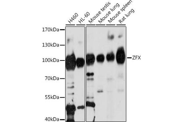 ZFX anticorps  (AA 180-380)