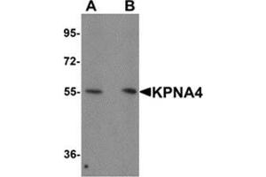 Western blot analysis of KPNA1 in Hela cell lysate with KPNA1 antibody at 1 μg/ml. (KPNA4 anticorps  (N-Term))