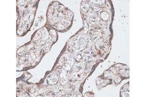 Immunohistochemistry of paraffin-embedded Human placenta using LMO4 Polyclonal Antibody at dilution of 1:100 (40x lens). (LMO4 anticorps)