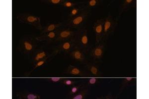 Immunofluorescence analysis of C6 cells using CBX3 Polyclonal Antibody at dilution of 1:100. (CBX3 anticorps)