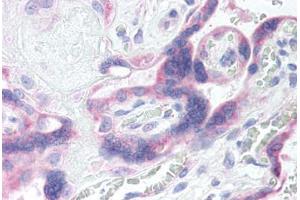 Human Placenta (formalin-fixed, paraffin-embedded) stained with GRK5 antibody ABIN290254 at 20 ug/ml followed by biotinylated goat anti-rabbit IgG secondary antibody ABIN481713, alkaline phosphatase-streptavidin and chromogen. (GRK5 anticorps  (AA 350-400))