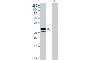 Western Blot analysis of KITLG expression in transfected 293T cell line by KITLG MaxPab polyclonal antibody. (KIT Ligand anticorps  (AA 1-245))