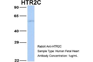 Host:  Rabbit  Target Name:  HTR2C  Sample Type:  Human Fetal Heart  Antibody Dilution:  1.