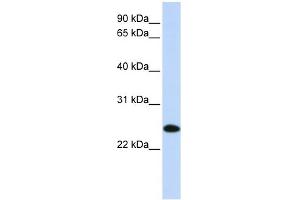WB Suggested Anti-UBE2K Antibody Titration: 0. (UBE2K anticorps  (N-Term))