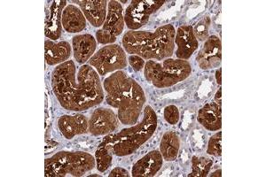 Immunohistochemical staining of human kidney with C11orf54 polyclonal antibody  shows strong cytoplasmic and nuclear positivity in cells in tubules. (C11orf54 anticorps)