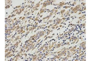 Immunohistochemistry (IHC) image for anti-Proliferation-Associated 2G4, 38kDa (PA2G4) antibody (ABIN1876564) (PA2G4 anticorps)
