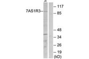 Western blot analysis of extracts from Jurkat cells, using TAS1R3 Antibody. (TAS1R3 anticorps  (AA 326-375))