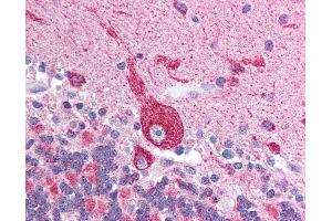 Anti-VDAC2 antibody IHC of human brain, cerebellum.