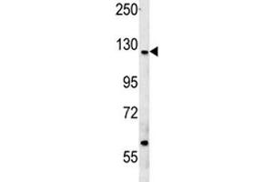 CUX1 antibody western blot analysis in MCF-7 lysate