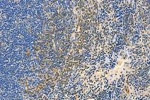 Immunohistochemistry analysis of paraffin-embedded mouse spleen using,BLNK (ABIN7073174) at dilution of 1: 3000
