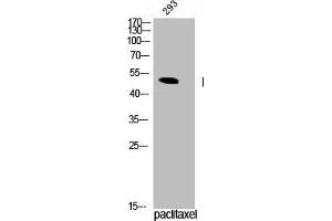 Western Blot analysis of 293 cells using Phospho-TPH1 (S58) Polyclonal Antibody (Tryptophan Hydroxylase 1 anticorps  (pSer58))