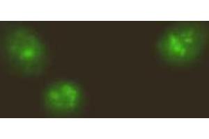 Immunofluorescencechemistry. (NF-kB p65 anticorps  (N-Term, NLS Domain))