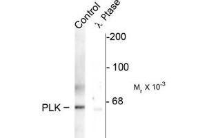 Western blots of rat synaptic membrane showing specific immunolabeling of the ~66 k PLK protein phosphorylated at Thr210 (control). (PLK1 anticorps  (pThr210))
